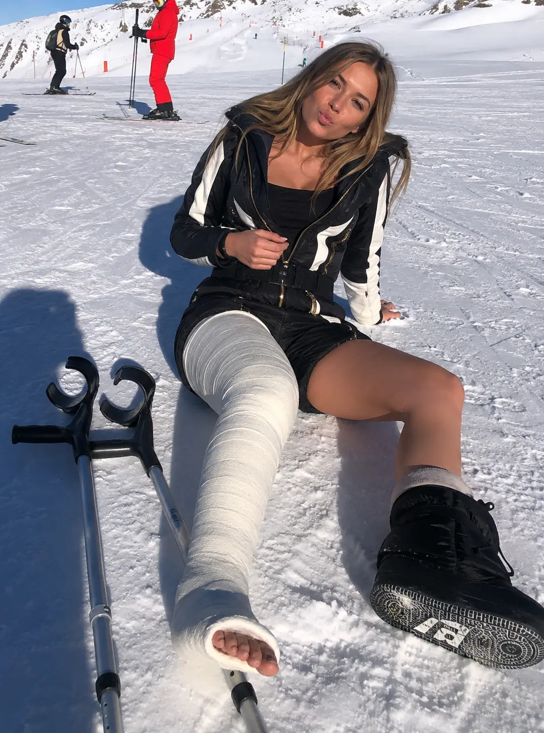 Example AI-generated leg cast photo made with Castlife Studio