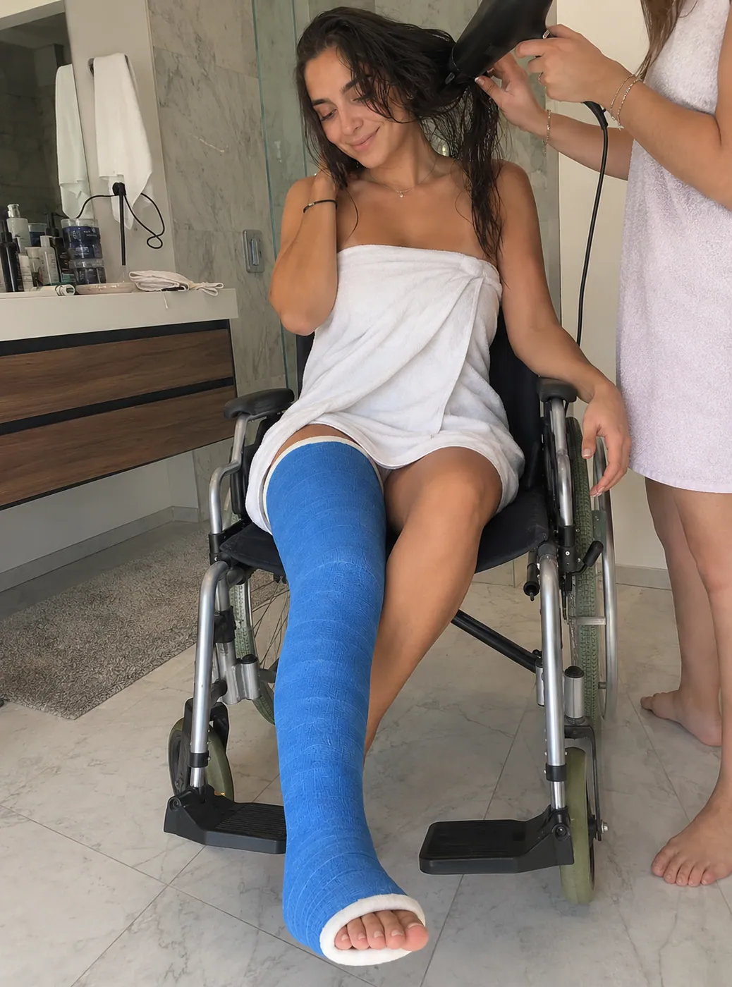 Example AI-generated leg cast photo made with Castlife Studio