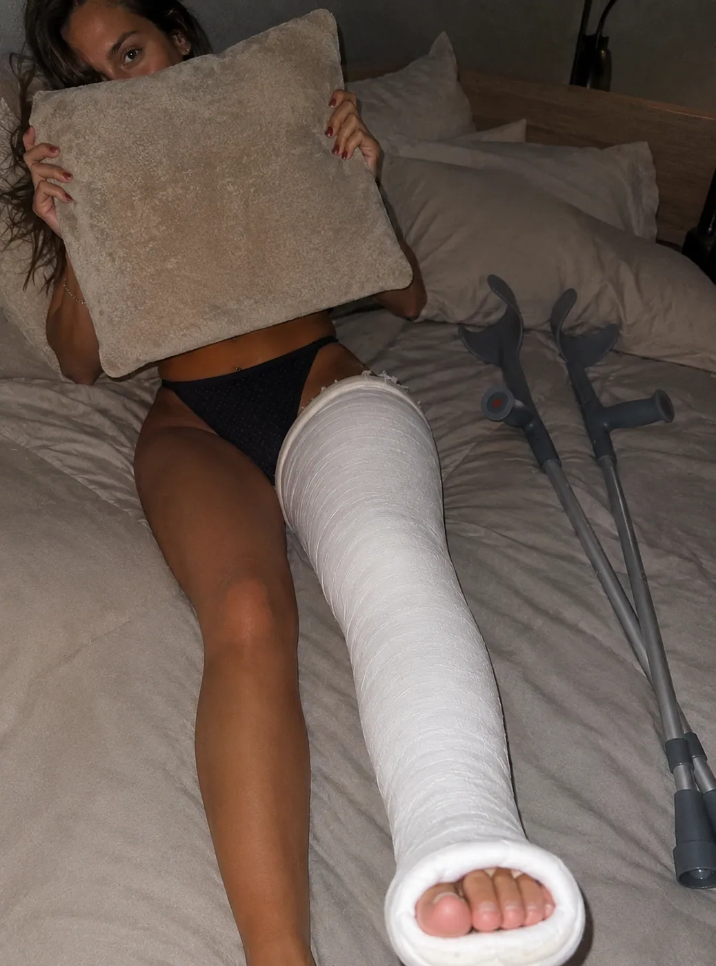 Example AI-generated leg cast photo made with Castlife Studio